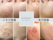 ハダイ(HADAY)