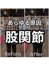 カワル整体 上通り院/股関節が重要なワケ