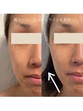 ひっそり美肌構築/初めてのフェイシャルエステ♪