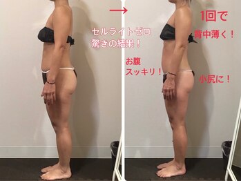 オージャス(OJAS)/40代○○様の変化 痩ボディーへ