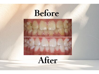 ニコ(nico)の写真