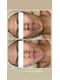 ワイズルミエ(Y's Lumie)の写真/【メンズも大歓迎◎】毎朝のヒゲ剃りをラクに！最新メンズ脱毛＆セルフホワイトニングで第一印象UP★