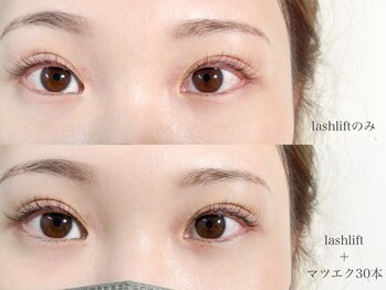 エイトラッシュ(8-lash)/lashlift ＋ マツエク(30本)