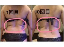 クレアボディ(CREA BODY)/背中