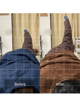 ナオル整体 池袋院(NAORU整体)/下半身の施術前後【池袋駅整体】