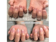 エルミュ(elmu)の雰囲気（自爪育成）