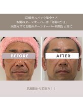 コンバートビューティーオタイ(ConBert Beauty otai)/若見え【短期集中ケア】