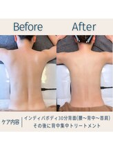 スー(Sue)/腰から上30分before→after