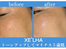 ルーミー(LUME.)/韓国最新ピーリング／セラピール