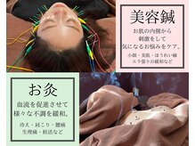 エクラ(Eclat)