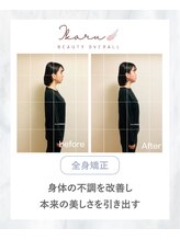 イカル 池袋(ikaru)/全身矯正 before after 06