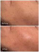 ククル(KUKULU)/ハーブ９回目♪（60代女性）