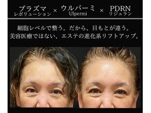 小顔ウナ学芸大学店(UNA)
