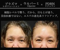 小顔ウナ学芸大学店(UNA)