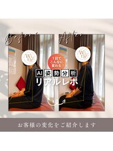 うぃず鍼灸整骨院/【AI姿勢分析】変化を可視化◎1