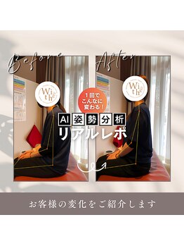 うぃず鍼灸整骨院/【AI姿勢分析】変化を可視化◎1