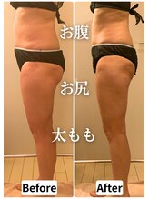 リエンシン(Riensin)/【レッドショット】痩身効果も◎