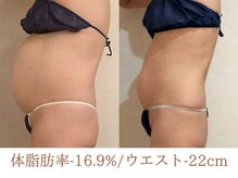 美ジン なかもず(美JIN)/セルゼロ全身40回