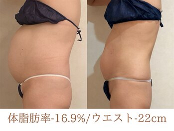 美ジン なかもず(美JIN)/セルゼロ全身40回