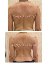 エムグレイス(m-grace's)/幹細胞インディバボディ