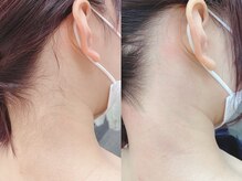 ネイル アンド アイラッシュ グレイス(Grace)/うなじワックス