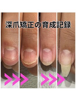 グレースレディ 神戸北店/