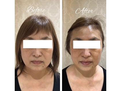 サロン ド スー(Salon de Suu)の写真