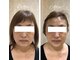 サロン ド スー(Salon de Suu)の写真