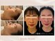 アメリ―ボーテ 恵比寿(Amelie beaute)の写真