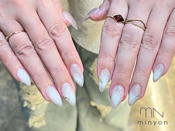 ミニョン(Minyon)の写真/経験豊富な高技術スタッフによる施術で爪のコンプレックスやお悩みを解消★深爪・爪の形・割れやすい等