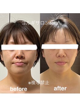 ソラ(sola*)/圧倒的な輪郭美人