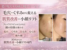 ラナン パラフューズ(Ranun's PARAFUSE.)