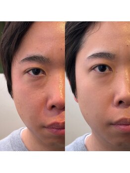 メンズ眉毛サロン&毛穴洗浄 HAK.銀座【ハク】MEN'Sアイブロウサロン/眉毛パーマ/