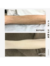 ラポール(rappore;)/メンズウデ脱毛