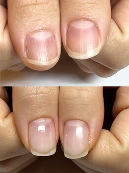 マリーロール 梅田店(Marie Laure)/自爪育成/深爪矯正/ネイルケア