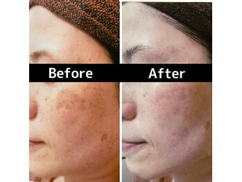 ブランシェ 金沢店 × 椿/シミケア　『50代お客様』