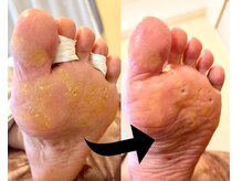 フットタイムズ(FOOT TIMES)の雰囲気（魚の目もお任せください．）