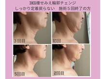 ルキア(LUKIA)の雰囲気（回数重ねてしっかり定着！周りから痩せたと言われちゃお！）
