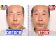 アジーク(AGEQUE)の写真