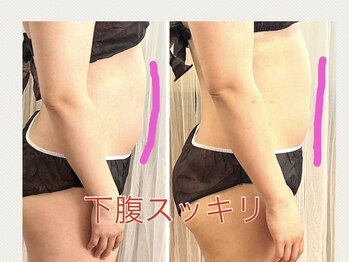 ヨサパーク ひだまり 日立店(YOSAPARK)/お腹薄くなれます