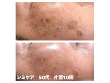 シシラ(shishira)の雰囲気（シミケアで肌質改善＆クリアな若見え肌へ！）