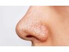 【毛穴レス肌へ】気になる毛穴にお悩みごとにアプローチ