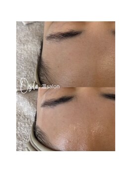 お肌をきれいにしたい