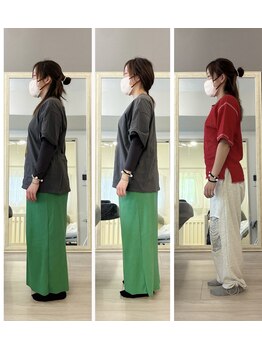リスリム(Re:slim)/初回施術後→2ヶ月半