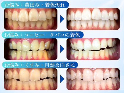 LBSホワイトニング 渋谷店の写真