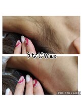 ハナ(HANA)/うなじワックス脱毛