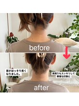 リリーボワ(LillyBois)/肩甲骨はがし