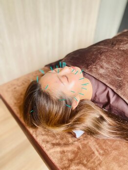 リハリ 本町院(///Rehari)/美容鍼