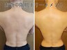 背中美人！ニキビケア＆ザラツキケアですべすべ引き締め背中美人施術60分程