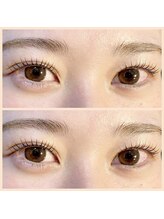 アトモス サニーテラス(Atmos sunny terrace)/奥二重　まつパ